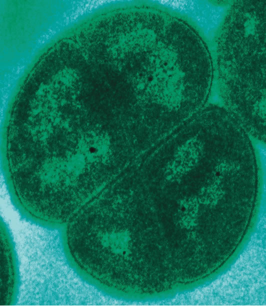 Deinococcus Radiodurans Bacterium
